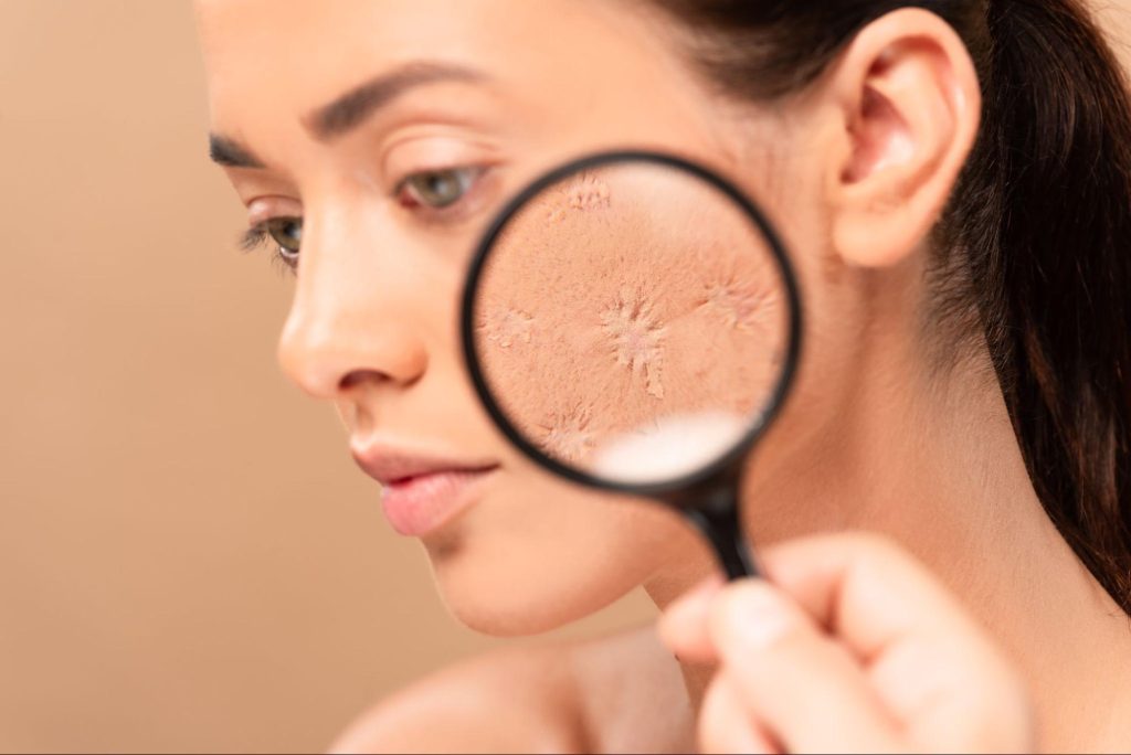 Busting 12 Myths About Pores