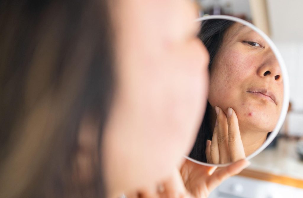 9 Practical Ways to Minimize the Appearance of Pores